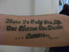 Hannah Beharry's Arm